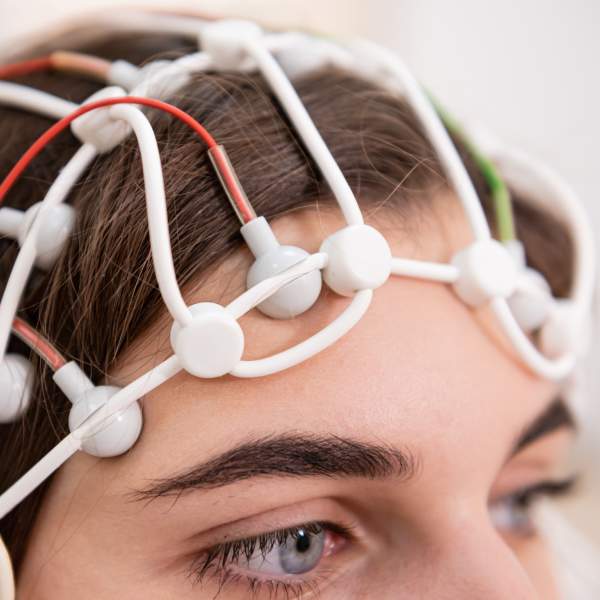 Neuromodulação